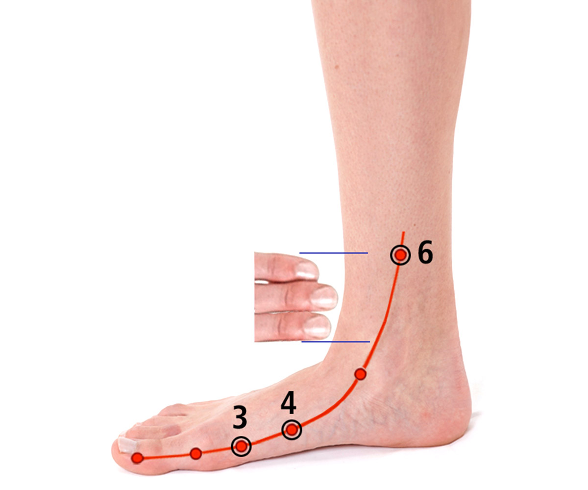 MAUX DE VENTRE CROSSPUNCTURE